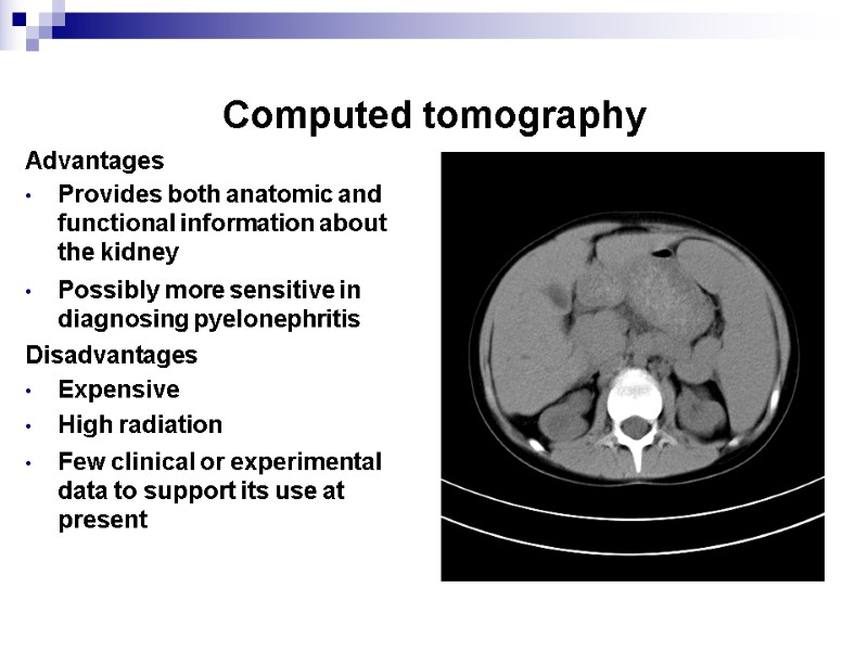 Computed tomography  Advantages Provides both anatomic and functional information about the kidney 